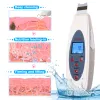 Instrument KonMison Ultrasonic Skin Petel Scrubber Cleanser czyszczenie twarzy masażer usuwania trądziku do twarzy Ultradźwiękowe obieranie czystego dźwięku