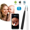 Trimmers WiFi Digital Ear Wax Removal Endoscope, Wireless Visual Ear Picker, Earwax Cleaner Tool, IOS, Android, MAC, 1080P