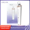 Instrument Anlan Blackhead Remover Vacuüm Zuiging Diepe poriereiniger Elektrische gezichtsneus Neus Face Acne Puistjes Verwijderen Huidverzorgingsgereedschap