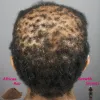 Schampokonditionering 100% naturliga hårstödprodukter för extremt hårväxtstopp alopecia och hår tunnare med denna kraftfulla behandling