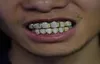 18 -karatowy złoty miedziany hip -hopowy mrożony wampir zębów fang grillz dentystyczne usta grille szelki rocka biżuteria do raku biżuterii do cos9323259