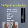 Armes à feu vitiligo sur couverture couverte corrective lotion Patchs blancs de la maladie du stylo de maquillage non traitement ce qui est vitiligo