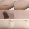 Tatuaggi tatuaggi copertina per la pelle color cicatrice adesivo correttore sottile pelle copertura invisibile artefatto artificiale cicatrice tatuaggio cicatrice difettini nascosti
