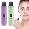 Instrument EMS hudskrubber ultraljud vibrationskalningsmaskin Positiv negativ jon Acne Por Blackhead Remover Firming Face Cleaner