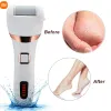 Controle Xiaomi Mijia Elektrische voetmolen Hielbestand slijpen Exfoliator Pedicure Hard Dead Skin Removal Professional File Care Tool