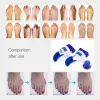 Traitement Bunion Splint lissener Big Toe Corrector Foot Doule Relief Hallux Valgus Correction orthopédique Bone Bumb Foot Care Treat