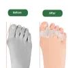 Behandling Pexmen 2st/par Gel Toe Separators HAMMER TOE RÄTTARE SPACER Överlappande tåkorrigeringsinriktning Lindra bunionsmärta