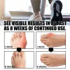 Tool EELHOE Foot Care Socks Therapy Health Care Warm Comfort Breathable Ankle Socks Foot Heel Massager Pain Relief Soft Cushion Pad