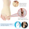 Behandling 2stå Toe Separator Hallux Valgus Bunion Corrector Orthotics Fötter Ben Tume Justerare Korrigering Pedikyrstrumpa Rättare Verktyg