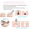 MASKIN MINI PORTABLE DIAMOND MICRODERMABRASION MASKIN SUCTION POWER PROFESSIONAL DERMABRASASION HEM ANVÄNDNING Ansiktsutrustning