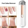 Fichiers Foot Callus Remover Electric Foot Fichier USB RECHARGETTE DRÉE DRÉE DES MACHINE DE RELOVER MACHINE DE THEE