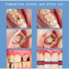 Dentifricio dentifricio denti strumenti di pulizia della riparazione delle cavità carries rimozione delle macchie di placca decadimento ingiallito denti denti sbiancamento