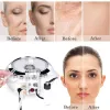 Machine Professional Diamond Microdermabrasion Dermabrasion Machine Home Gebruik Facial Beauty Salon Wrinkle Face Peeling Equipment