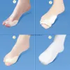 Behandlung 2pcs Fußpflegewerkzeug Silikongel Daumen Korrektor Bunion Fuß Zehen Hallux Valgus Protektor -Separator Finger Glättung Einverstand