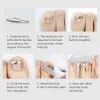 Verktyg Ingrown Toenail Corrector Tools Pedicure Recover Emce Toe Nail Treatment Professional Ingrown Toenail Correction Foot Care Tool Tool