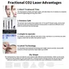 Beste Qualität HF CO2 BRACTIONAL LASERLASERNETZUGFREIDUNG RESURFACKING VON JUVENATION ACNE NARTE Wrinkelnentfernung CO2 Lasermaschine