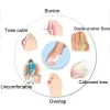 Leczenie Silikonowy Koron kciuki Mały stóp Separator Separator Valgus Finger Palce Stopa pielęgnacja pielęgnacji podkładki pomocy narzędzie