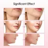 EMS MicroRirent V Face Lifting Machine Trilling Verwarming Gezichtsmassager Firming Skin Removal Dubbele kin schoonheid liftgordel 240425