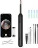 BEBIRD-Xlife Ear Wax Removal Tool Ear Camera - XLife 1080P HD Otoscope with 6 LEDs Light, Visible Ear Cleaner with 4 Replacement Earpick Tips for Cleaning Earwax