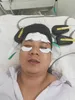 EMRF-Face Замена гелевого пластыря для EMRF машины для подтяжки глаз и лица, мышц лица, электромагнитных магнитных V-образных лиц