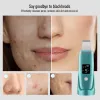 Instrumento Ultrassônico Espor ultrassônico EMS Poro facial de limpeza profunda Espátula Blackhead Dead Skin Removedor de acne Acne RECURSO REVECENDO MASSAGER