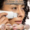 Peeling ad ultrasuoni Dispositivo di rimozione dei punti neri Scrubber per la pelle Pala Pulizia profonda Rimozione del lifting del viso Pori Acne EMS Lift240227