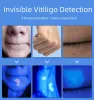 Analyseur portable Blue LED Cold Light Light Analyzer Wood UV Magnification de lampe UV Effet d'analyse de la peau Détection de vitiligo
