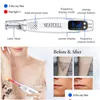 Face Care Devices Picosecond Laser Pointer For Mole Removal Dark Spot Pen Tattoo Acne Skin Pigment Portable Hine Beauty Device Drop D Dhx3B