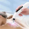 Producten Elektrische Acupunctuurpen Pijnbestrijding Therapie Spiergenezing Acupunctuurpen 9 Intensiteit Deep Tissue Massage Relief Pijnhulpmiddelen