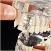 Artes e ofícios Modelo de dentes de doença de implante dentário com ponte de restauração Dentista para ensino de ciências Study13594528 Drop Del Dh9Nr