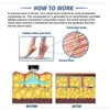 Shockwave Therapy Machine Body Dual Linear Shockwave Machine Electromagnetic Shockwave Therapy Shock Wave