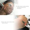 Fabrieksprijs Picosecond Laser Enkele of dubbele lampstaaf Picosecond Laser Tattoo Removal Nd Yag Laser Machine Stationaire sproetverwijdering