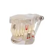 Autre modèle d'implant d'hygiène bucco-dentaire Maladie Dents Réparation neuronale Pathologique Typodont Restauration Pont Enseignement Étude Science 230915