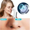 Face Care Devices Electric Small Bubble Blackhead Remover USB Water Cycle Pore Acne Pimple Removal Vacuum Suction Nose Cleaner Tool 230920