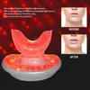 Dispositivi per la cura del viso LED Luce rossa Dispositivo per rimpolpare le labbra Potenziatore elettrico rimpolpante Naturale Sexy Più grande Labbra carnose Ingranditore Labios Aumento Pompa 230926