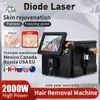 2024 Nuovo 808nm Ghiaccio Laser a diodi di titanio Depilazione 755 1064 per la casa Rimozione permanente Testa di raffreddamento Epilatore laser indolore