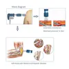 Assistenza sanitaria dimagrante Apparecchiatura per terapia della disfunzione erettile con onde d'urto Dispositivo per terapia d'urto con onde d'urto per alleviare il dolore