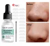 Retire la esencia de Blackhead para eliminar la reparación hidratante córnea