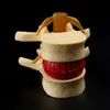 Filing Supplies Lumbar Vertebrae Model Anatomical Spine Disc Herniation Anatomy Teaching Tool 230803