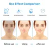 Face Massager Lesen Wireless Rechargeable 7 Color LED Treatment Mask Skin Tightening Massager Skin Care LED Mask For Skin Lifting 230810
