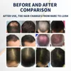 Traitement de perte de cheveux Laser croissance des cheveux le plus populaire doux 630nm/480nm équipement de repousse des cheveux au Laser électrique pour femme et homme