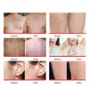 2023 Latest 808nm diode laser hair removal machine screens Android system lazer hair reduction beauty equipment for spa salon