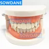 Other Oral Hygiene Dental Tooth Model Teeth Model Dental Caries Model for Patient Communication Dentist Study Model with Decayed Tooth 230815