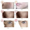 Face Massager 7-Color LED Mask Potherapy Face Machine Skin Rejuvenation Anti Acne Wrinkle Removal Skin Care Mask Skin Brightening 230814