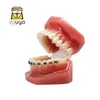 Other Oral Hygiene Dental Model With Braces Dentistry Materials Orthodontic Models Gum Tooth Teeth Model For Studying Teaching Patient Education 230815