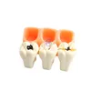 النظافة الفموية الأخرى 1PCS نموذج تعليم الأسنان نموذج المريض مشوه الأسنان نموذج الأسنان عن طريق الفم يمكن إزالة نموذج أسنان الأسنان عن طريق الفم يمكن إزالة نموذج مختبر الأسنان 230815