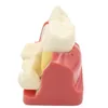 Andere orale hygiëne tandheelkundige leer implantaatanalyse kroonbrug verwijderbaar model tandheelkundige demonstratie tanden model 230815