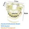 Outros dentes ortodônticos de higiene oral Modelo de dentes transparentes Modelo ortodôntico transparente com colchetes 230815