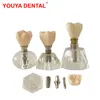 Inne higiena jamy ustnej dentysta kryształowy model implantu zęba przezroczystą praktykę implantów dentystyczny