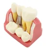 Andere orale hygiëne tandheelkundige leer implantaatanalyse kroonbrug verwijderbaar model tandheelkundige demonstratie tanden model 230815